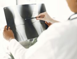 5 Kiat Mencegah Osteoporosis Agar Tulang Tetap Kuat